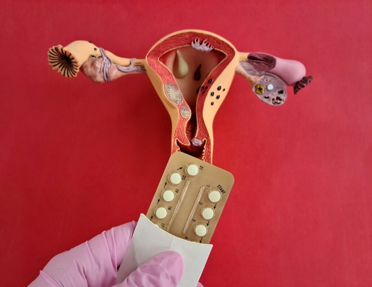 Perimenopauza hatása a bipoláris zavarra